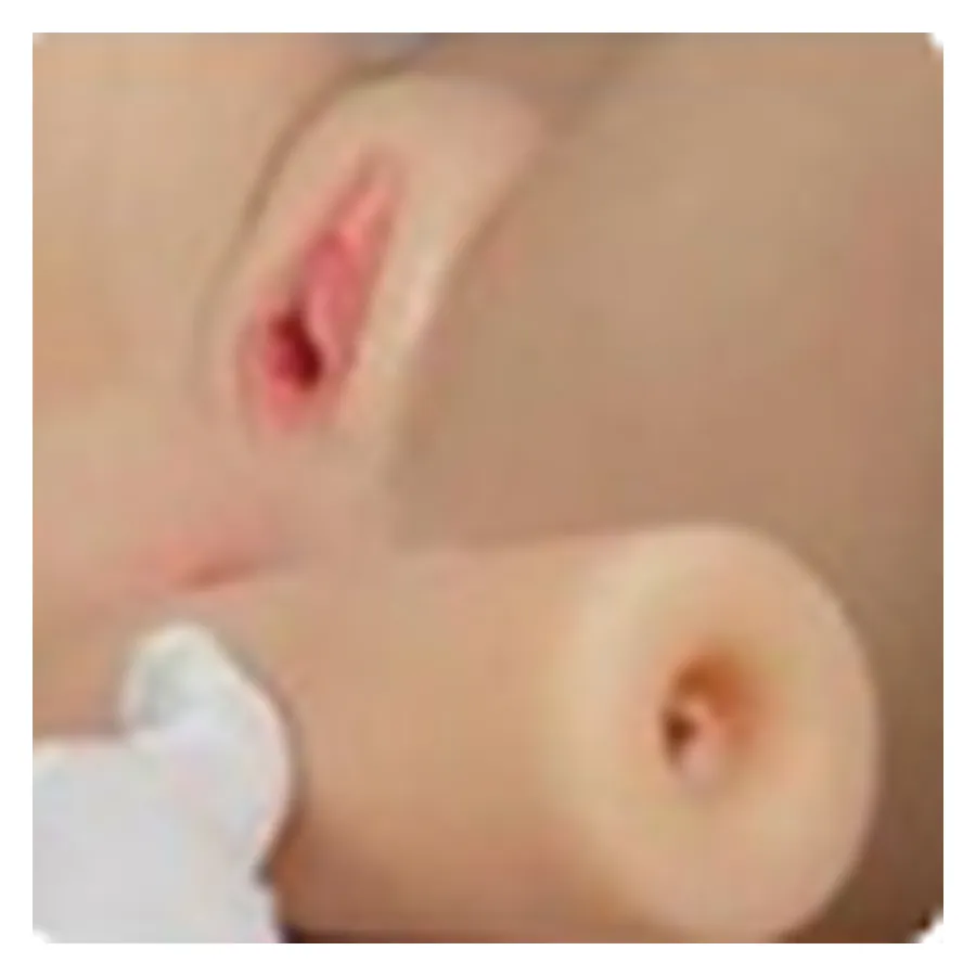 Vagina rimovibile